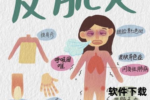 肌肉炎症的应对策略：抗炎药物与康复疗法解析