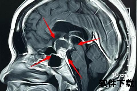 畸胎瘤确诊方法解析：影像学检查与病理诊断流程
