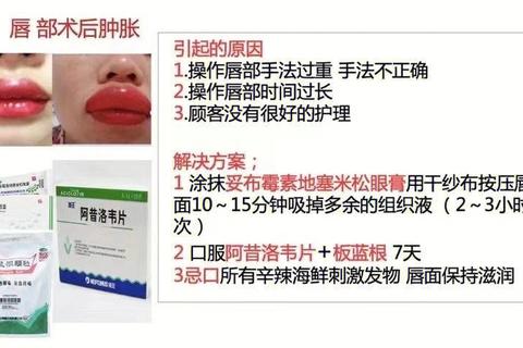 唇炎药物治疗指南：科学选药与护理要点解析