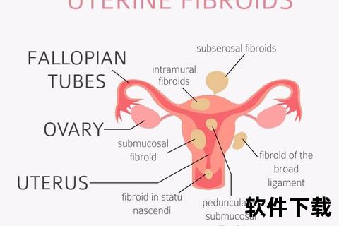 盆腔炎发病部位解析-女性盆腔结构及感染区域探讨
