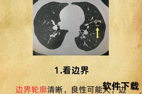 结节治疗方法解析-科学应对与患者指南