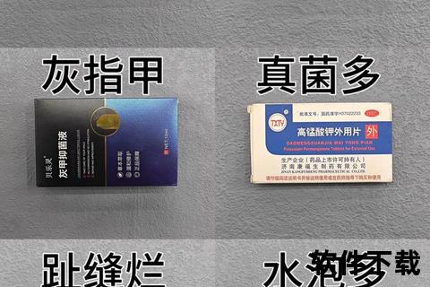 灰指甲外用药膏_专业杀菌修复配方-告别甲癣困扰重现健康指甲