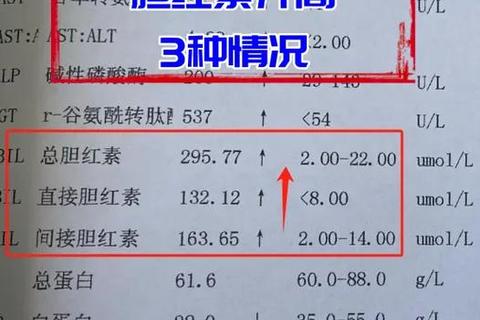 新生儿总胆红素升高_常见诱因及科学处理方式