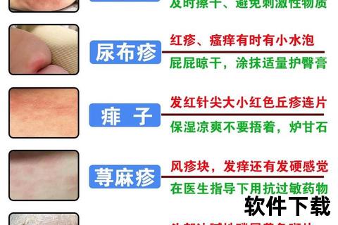 新生儿脸上疹子类型解析:痤疮_粟粒疹_湿疹护理