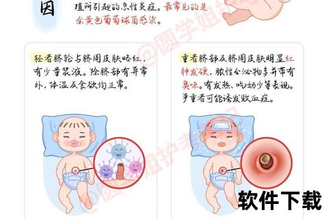新生儿脐带水肿:病理机制与临床干预策略探析 新生儿脐带水肿:病理机制与临床干预策略探析