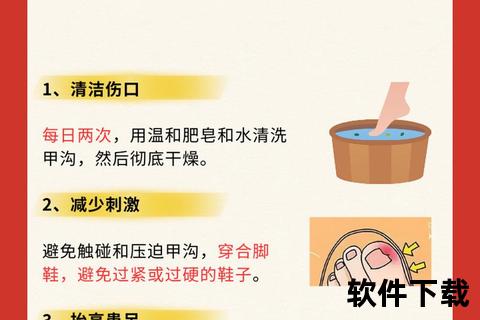 甲沟炎外用药膏使用指南:快速消炎止痛与日常护理要点