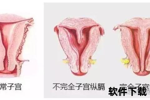 纵隔子宫解析_先天发育异常与妊娠影响