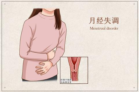 月经不调会影响怀孕吗-解析周期异常与生育能力关联