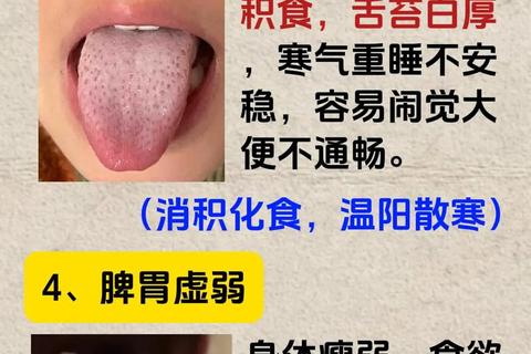 新生儿舌苔厚白-成因解析与科学护理