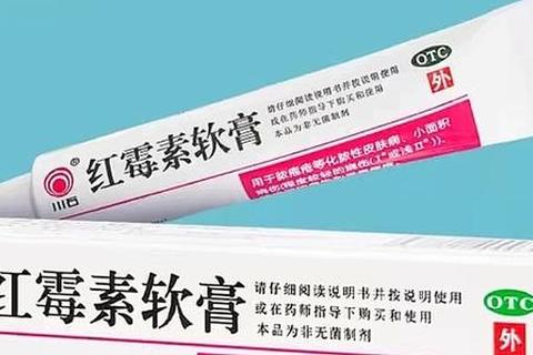 消炎药膏推荐指南：快速缓解红肿发炎的常用药膏解析