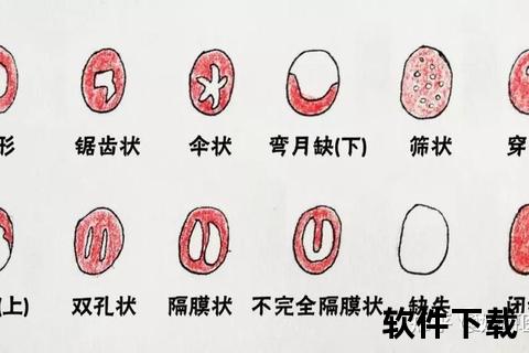 处女膜状态检查指南:自我观察与医学诊断方法 处女膜状态检查指南:自我观察与医学诊断方法
