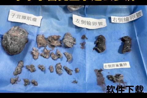 子宫囊肿致月经不调_病理机制与临床调理策略探析 子宫囊肿致月经不调_病理机制与临床调理策略探析