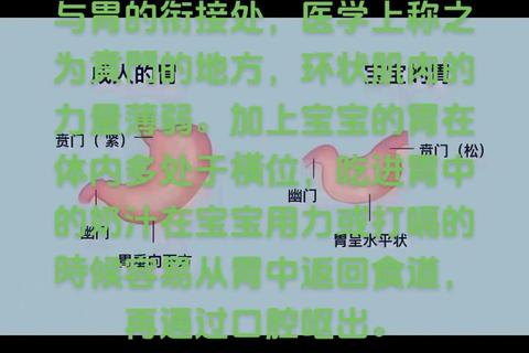 新生儿干呕原因解析：喂养不当、胃食管反流与感染因素
