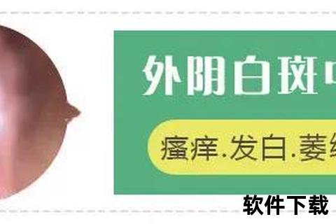 外阴白斑治疗新策略：综合疗法与症状缓解技巧