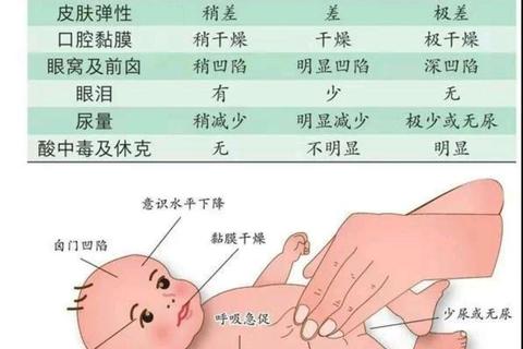 小孩脱水症状有哪些_如何识别与应对家长必知要点 小孩脱水症状有哪些_如何识别与应对家长必知要点