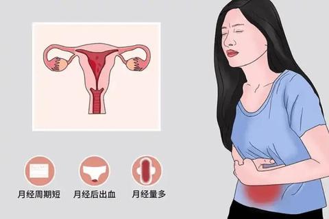 月经不调诱因解析：内分泌、生活习惯与疾病因素