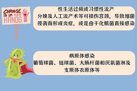 宫颈炎防治要点解析：病因机制与临床诊疗新进展