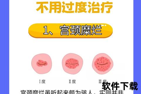 女性妇科疾病防治全解析：健康管理与科学应对指南