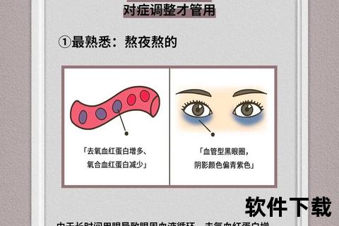 黑眼圈分类型护理指南：科学淡化方法与日常保养全攻略