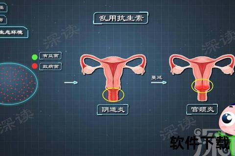 宫颈炎诱因解析：感染_损伤_免疫力低下与病原体侵袭