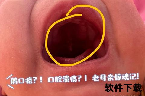 新生儿口腔白点_常见成因与科学护理方法详解