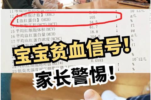 新生儿贫血怎么办_原因分析及科学应对方法详解