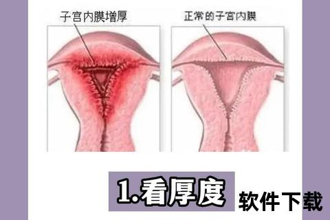 子宫内膜增厚：生理性还是病理性？解析激素、息肉与癌变诱因