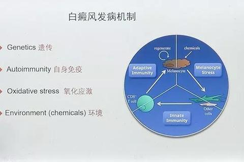 白癜风外用药研究进展：作用机制与临床疗效分析