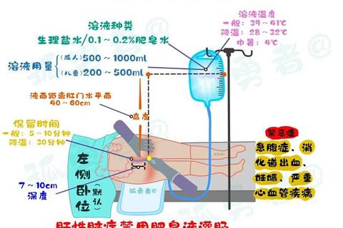 中药灌肠疗法在妇科疾病中的应用_临床疗效与治疗优势分析
