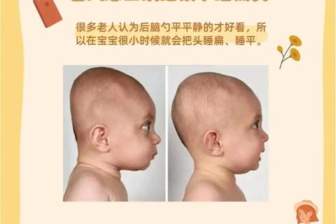 新生儿后脑勺骨头凸起：原因解析与应对建议