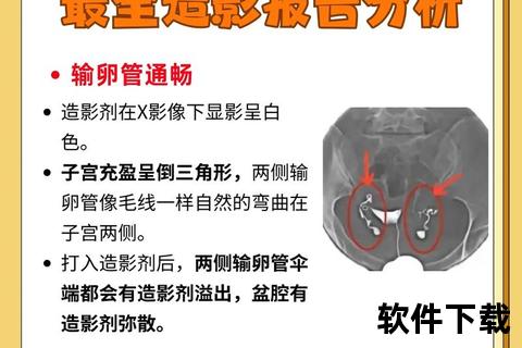 输卵管堵塞治疗策略:科学方法与有效手段详解 输卵管堵塞治疗策略:科学方法与有效手段详解