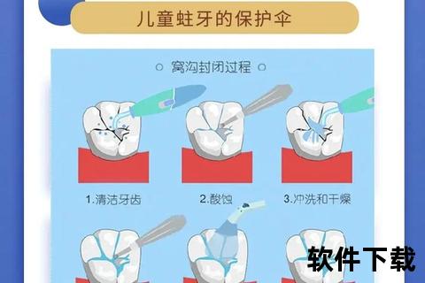 窝沟封闭_口腔防护关键步骤-含义_作用及适用人群全解析