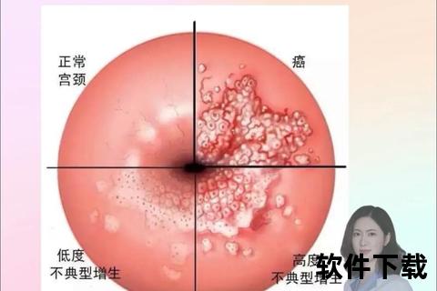 宫颈疾病常见类型与症状解析-预防措施及治疗方法详解