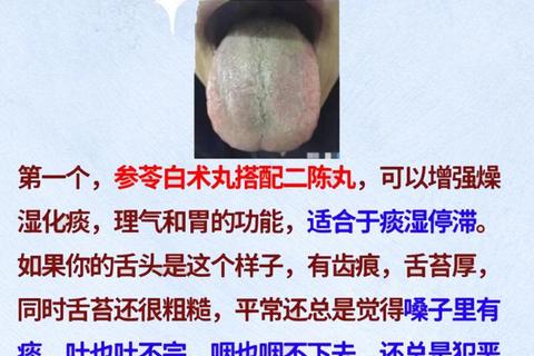 参苓白术丸功效与作用解析-适用症状及使用指南