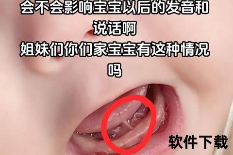 小孩舌系带短挂什么科_口腔科与儿科就诊指南