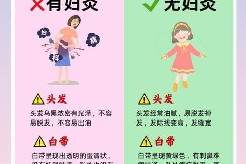 妇科炎症防治指南：女性健康管理及症状解析