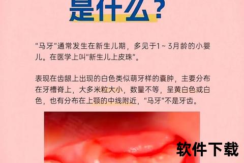 新生儿两侧大牙床发白：马牙与鹅口疮的辨别及护理要点