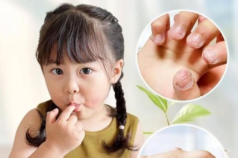 孩子啃指甲成因解析：心理习惯与潜在诱因探析