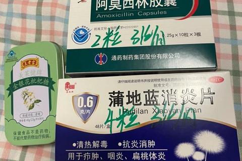 扁桃体发炎消炎药推荐_合理选择与正确用药指南