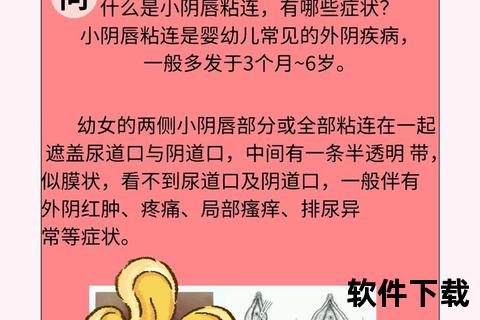 盆腔粘连解析_症状表现、成因及治疗方式说明