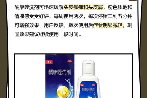 复方酮康唑洗发剂_去屑止痒控油三效合一与头皮护理方案 复方酮康唑洗发剂_去屑止痒控油三效合一与头皮护理方案