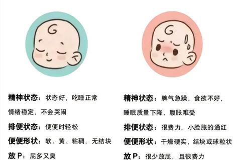 新生儿不排便仅放屁：肠道功能解析与应对措施