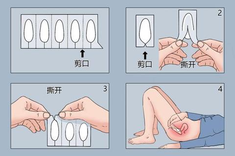 妇科栓剂使用指南-正确操作步骤与注意事项解析
