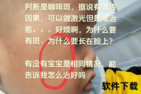 新生儿青记_皮肤色斑成因解析与家长关注要点