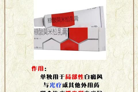 白癜风用药指南：外用药与系统药物的选择及联合治疗
