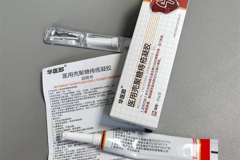 痔疮会引发妇科病吗_关联因素与健康防护解析