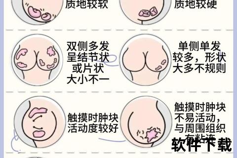 乳腺增生疼痛部位解析：常见区域与症状表现