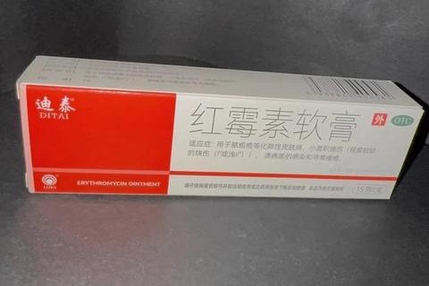 红霉素软膏消炎作用解析：正确使用方法与效果探讨