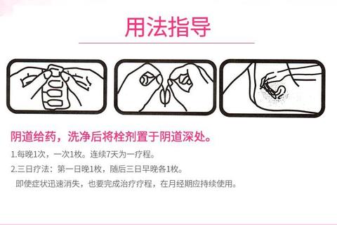 妇科消炎药口服指南：科学选药与安全用药全解析