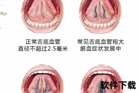 舌下含药新突破与舌诊疗法应用